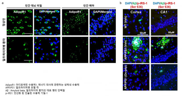 알츠하이머병 환자의 대뇌 피질과 해마에서 아디포넥틴 수용체가 감소한 형광 이미지(왼쪽), 알츠하이머병 모델 쥐에서 병리 단백질의 비정상적 응집이 9개 서열 펩타이드 처리 시 감소된 모습